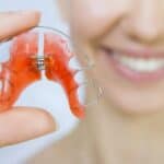 woman holds retainer
